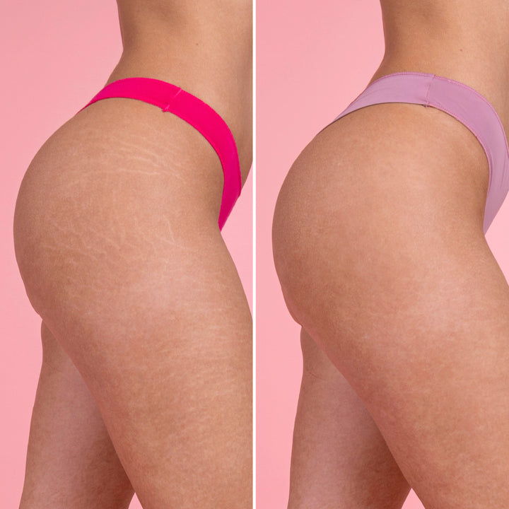 Crema Corporal Estrías y Cicatrices | Eco Bio Boutique