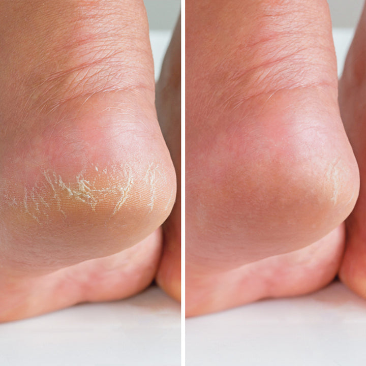 Exfoliante Regenerador para Pies - Suavizante e Hidratante | Eco Bio Boutique