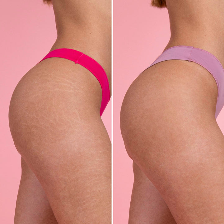 Set Antiestrías - Elastiza, Nutre y Regenera la piel | Eco Bio Boutique