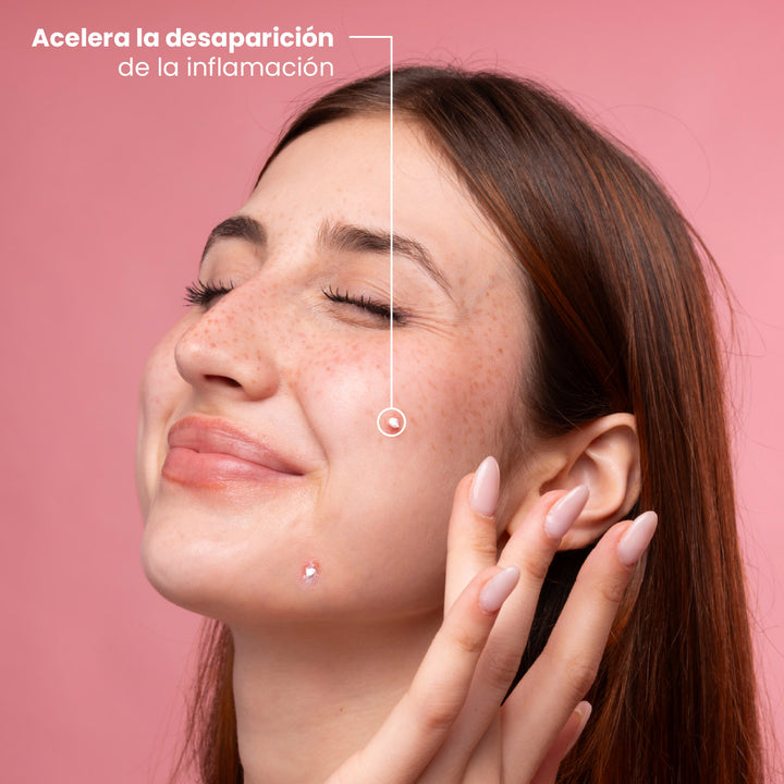 ByePimples Plus - Tratamiento de choque antiacné | Eco Bio Boutique