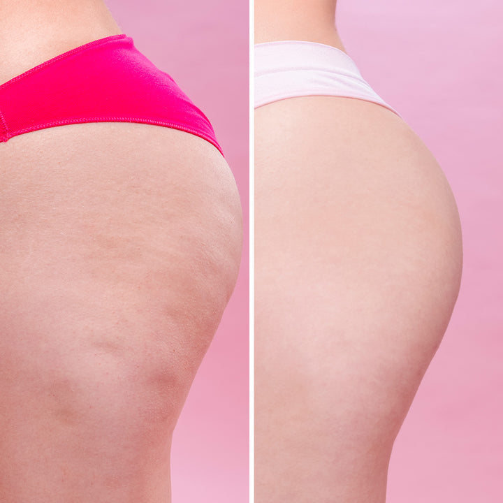 Cellulite Remover - Crema Anticelulítica de Acción Ultra Rápida | Eco Bio Boutique