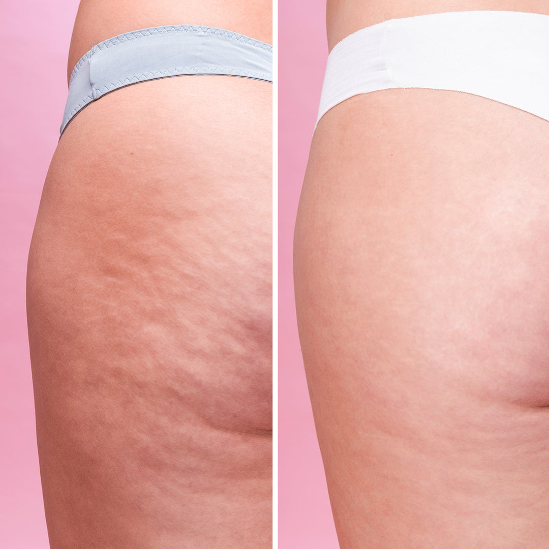 Cellulite Scrub - Exfoliante Corporal Anticelulítico | Eco Bio Boutique