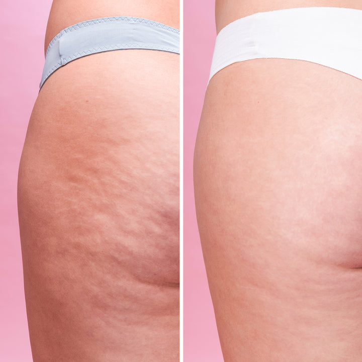Cellulite Scrub - Exfoliante Corporal Anticelulítico | Eco Bio Boutique