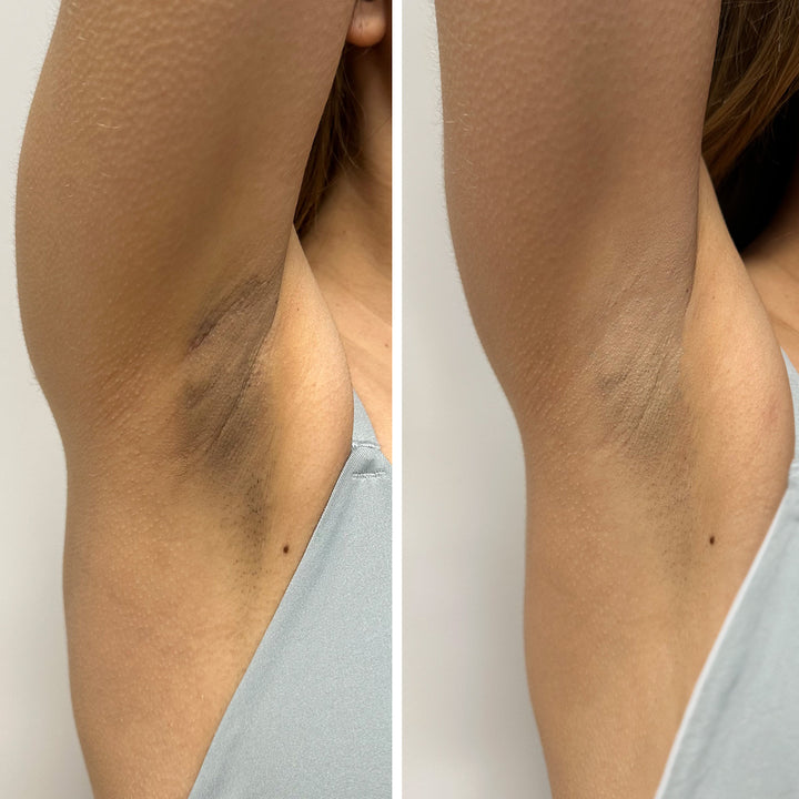 DeoScrub - Exfoliante para Axilas Blanqueador, Astringente y Antiolor | Eco Bio Boutique