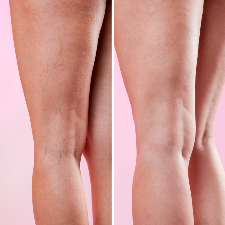 GoLegs - Crema Corporal Desfatigante | Eco Bio Boutique