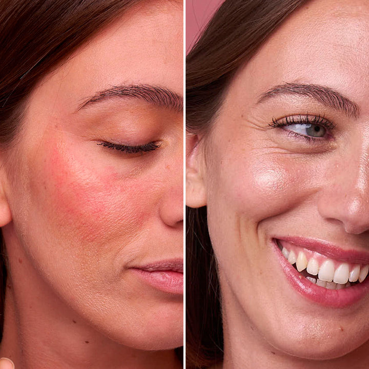 Rose - Aceite Facial Hidratante, Regenerador, Iluminador | Eco Bio Boutique